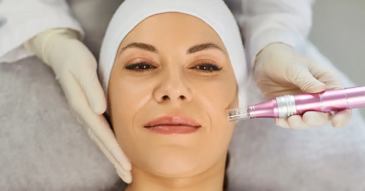Women Receiving Microneedling in Basking Ridge ,NJ