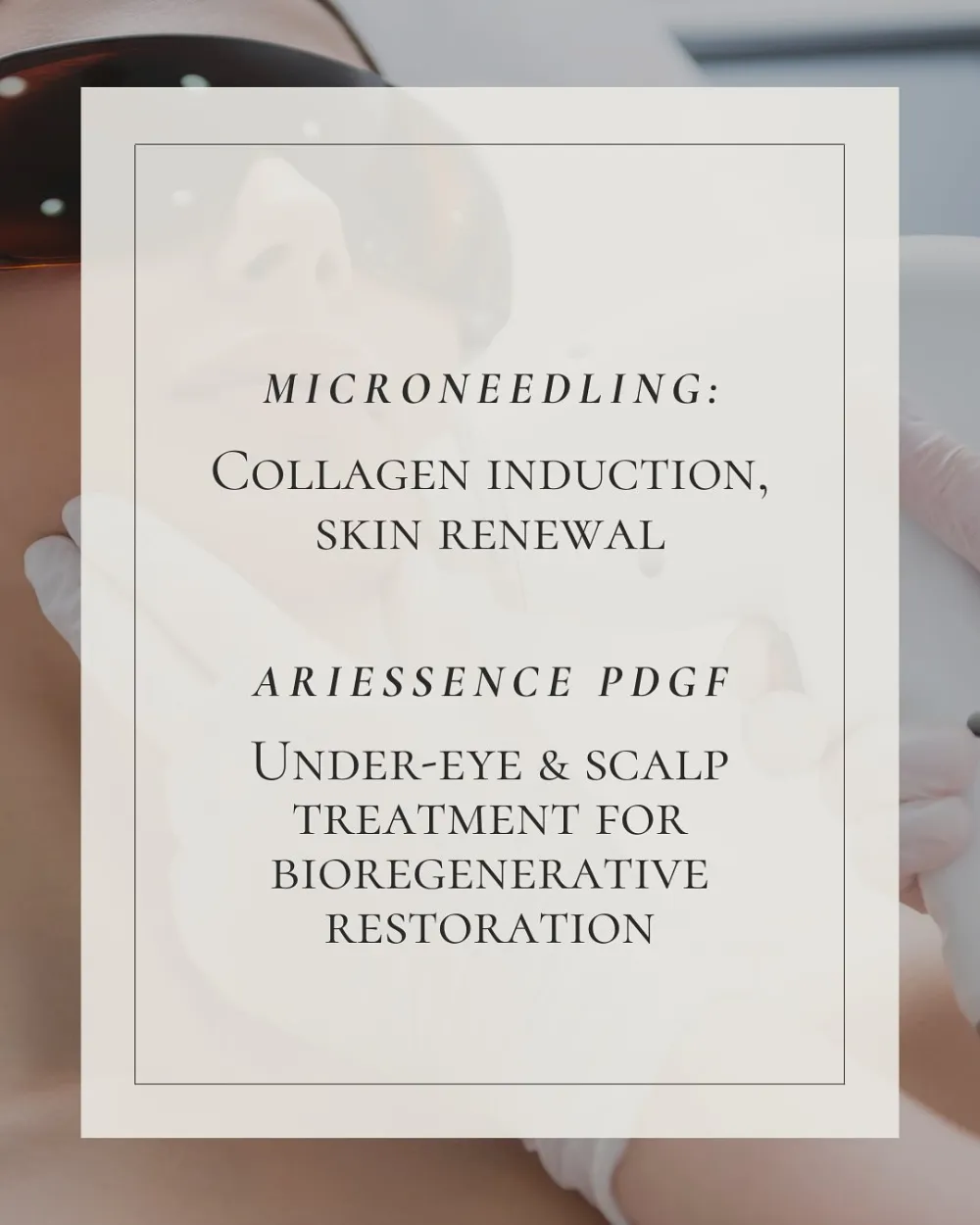 Microneedling and Ariessence PDGF treatment list | Medical Spa Basking Ridge NJ | Marée Aesthetics