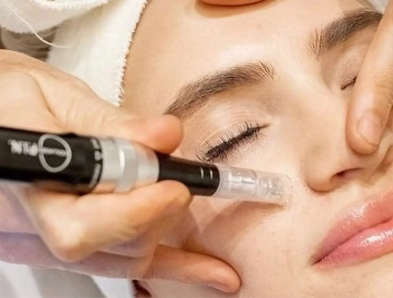 Microneedling Maree Aesthetics