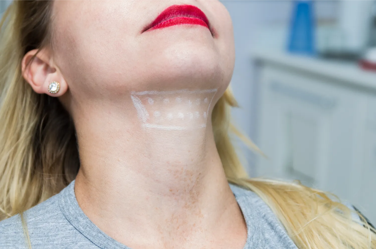 women receiving Kybella fat reduction in Basking Ridge, NJ | Medical Spa | Marée Aesthetics & Longevity