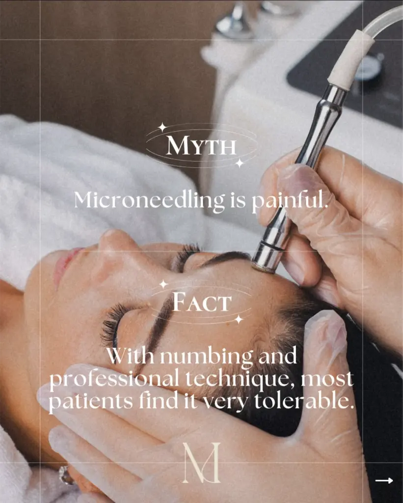 Educational myth and fact about microneedling with a woman receiving treatment | Medical Spa | Edinburg, TX | Marée Aesthetics